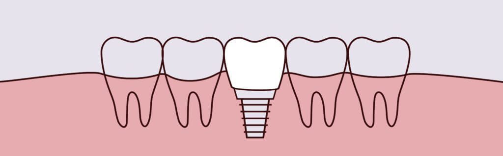 Precision Family Dental |