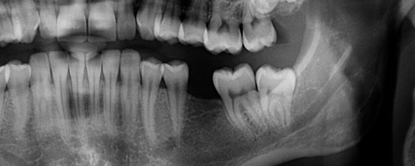Precision Family Dental |