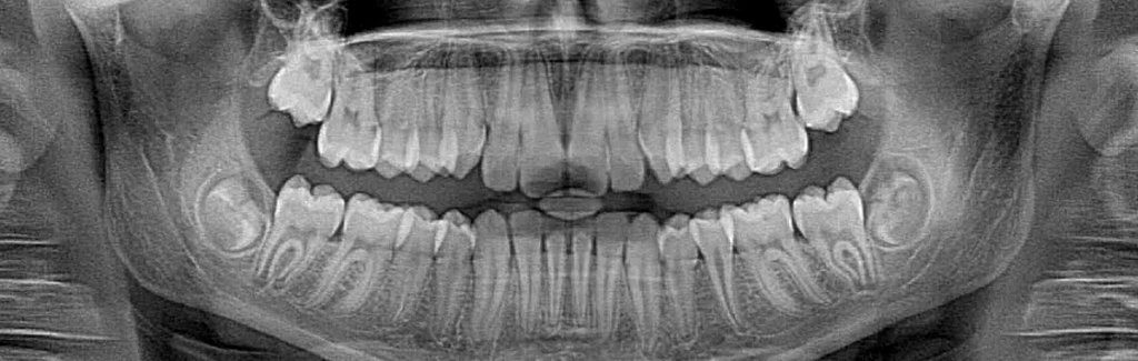 Precision Family Dental |