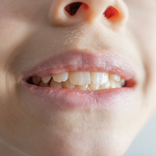 Precision Family Dental |